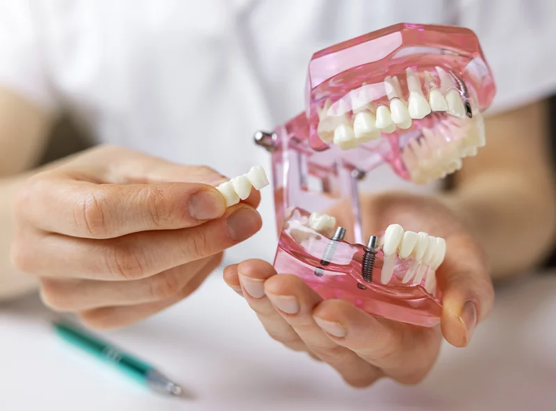 Demonstration of how a prosthesis works