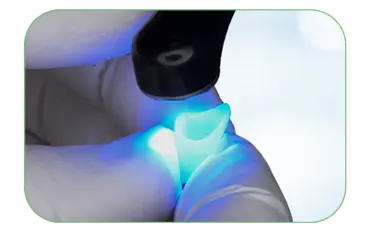 Light-cure for 10 seconds (if required for the primer).