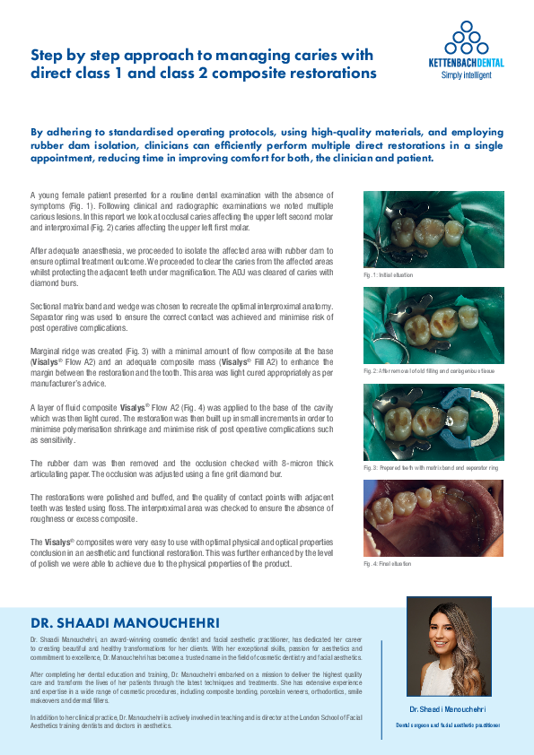 Step by step approach to managing caries with direct class 1 and class 2 composite restorations