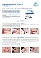 Nano-hybrid composites Visalys® Fill and Visalys® Flow