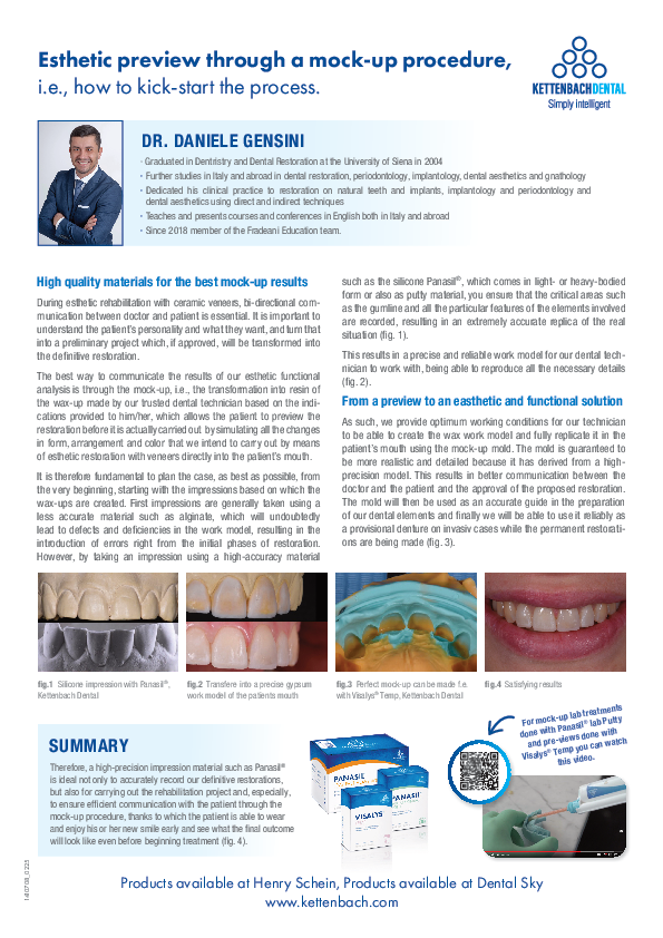 Esthetic preview through a mock-up procedure