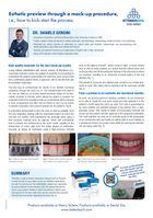 Esthetic preview through a mock-up procedure