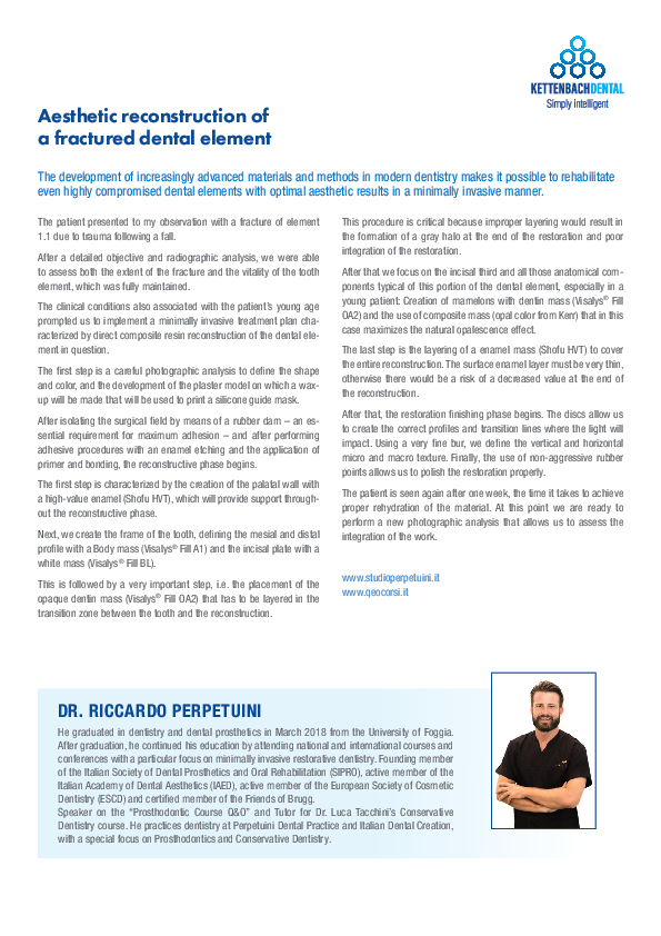 Aesthetic Reconstruction of a Fractured Dental Element
