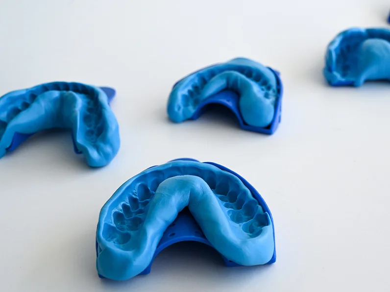 Blue dental impressions