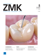 Bulk-fill resin composites: current overview of efficiency and evidence