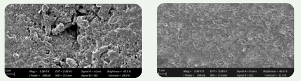 SEM Images of VISALYS BIOCERAMIC on the right against competitive material on the left. 